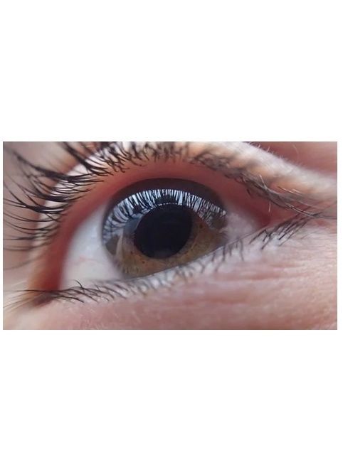 ปัญหาของดวงตา จอประสาทตาเสื่อม,วุ้นตาเสื่อม,ตาพล่ามัว,มีจุดในตาฯ  กับ นวัตกรรมAPCO